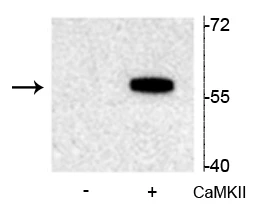 Anti-Tryptophan Hydroxylase (Ser19) Antibody