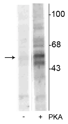 Anti-Tryptophan Hydroxylase (Ser58) Antibody