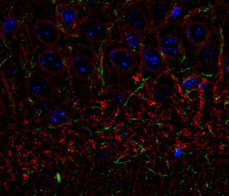 Anti-Tubulin, beta III Antibody - Image 3