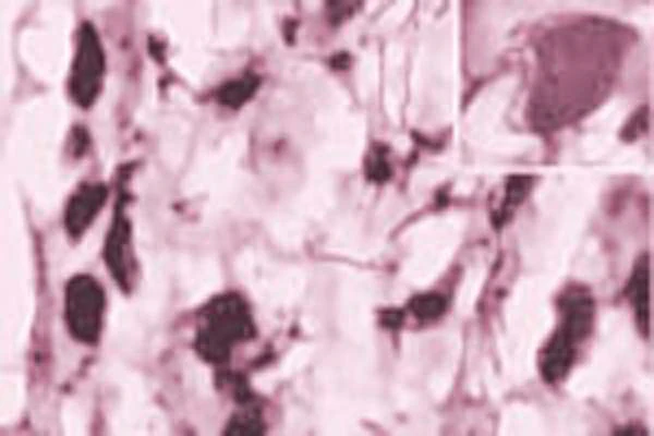 Anti-Tumor necrosis factor receptor superfamily member 19 (TROY) Antibody