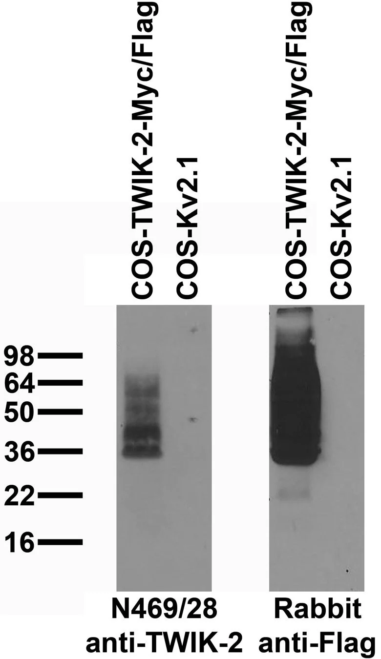 Anti-TWIK-2 Antibody