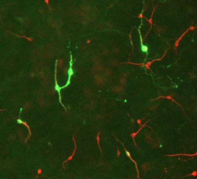 Anti-Tyrosine Hydroxylase Antibody - Image 3