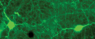Anti-Tyrosine Hydroxylase Antibody - Image 3
