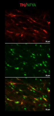 Anti-Tyrosine Hydroxylase Antibody (Ascites) - Image 4