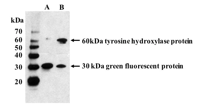 Anti-Tyrosine Hydroxylase Antibody (Purified) - Image 2
