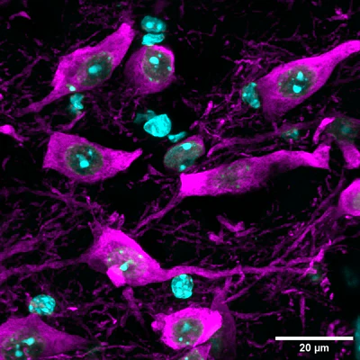 Anti-Tyrosine Hydroxylase (TYH) Antibody