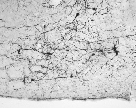 Anti-Tyrosine Hydroxylase (TYH) Antibody - Image 10