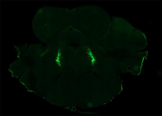 Anti-Tyrosine Hydroxylase (TYH) Antibody - Image 11