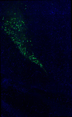 Anti-Tyrosine Hydroxylase (TYH) Antibody - Image 12