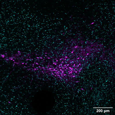 Anti-Tyrosine Hydroxylase (TYH) Antibody - Image 2