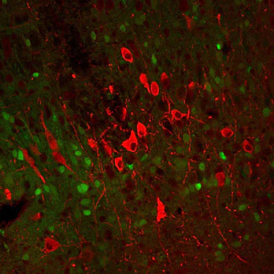 Anti-Tyrosine Hydroxylase (TYH) Antibody - Image 4
