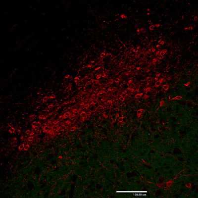 Anti-Tyrosine Hydroxylase (TYH) Antibody - Image 5