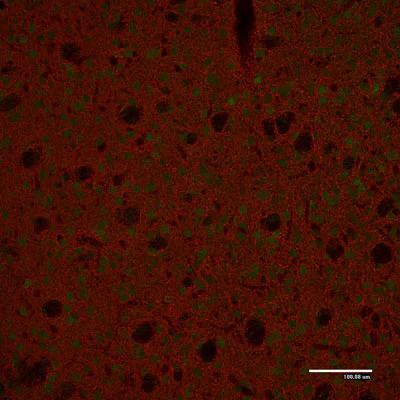 Anti-Tyrosine Hydroxylase (TYH) Antibody - Image 8
