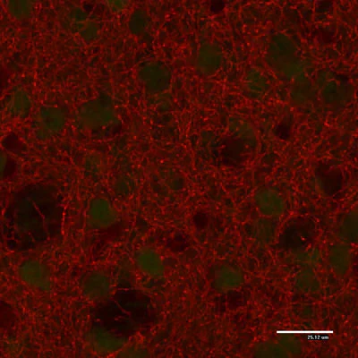 Anti-Tyrosine Hydroxylase (TYH) Antibody - Image 9