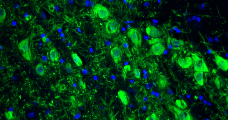 Anti-Tyrosine Hydroxylase Recombinant Chicken Chimeric mAb - Image 2