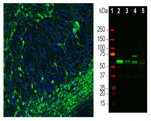 Anti-Tyrosine Hydroxylase (TH) Antibody