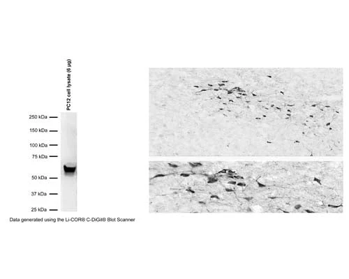 Anti-Tyrosine Hydroxylase (TH) Antibody