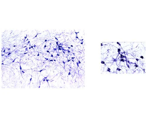 Anti-Tyrosine Hydroxylase (TH) Antibody - Image 2