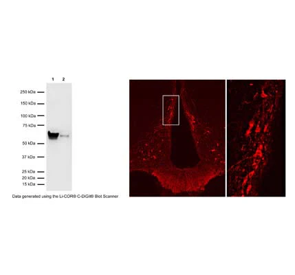 Anti-Tyrosine Hydroxylase (TH) Antibody