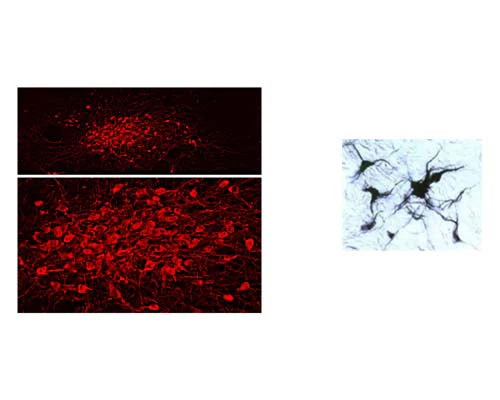 Anti-Tyrosine Hydroxylase (TH) Antibody - Image 2