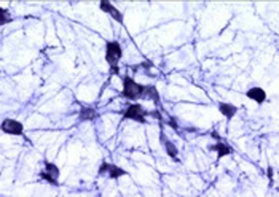 Anti-Tyrosine Hydroxylase (TH) Antibody