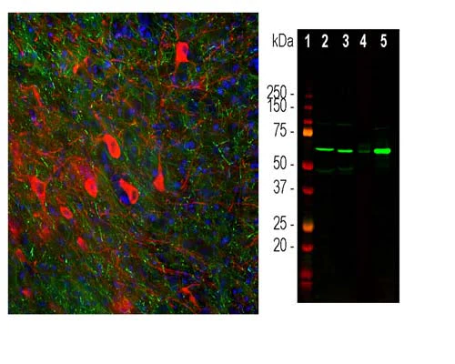 Anti-Tyrosine Hydroxylase (TH) Antibody