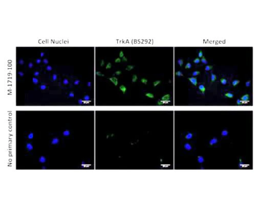 Anti-Tyrosine Kinase Receptor A (TrkA) Antibody - Image 4