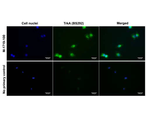 Anti-Tyrosine Kinase Receptor A (TrkA) Antibody - Image 5