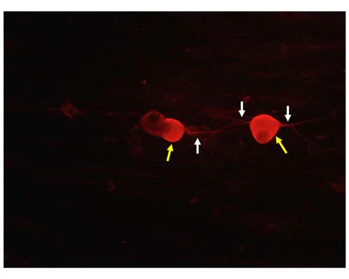Anti-Tyrosine Kinase Receptor A (TrkA) Antibody - Image 6
