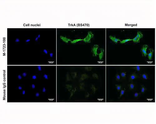 Anti-Tyrosine Kinase Receptor A (TrkA) Antibody - Image 2