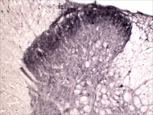 Anti-Tyrosine Kinase Receptor A (TrkA) Antibody