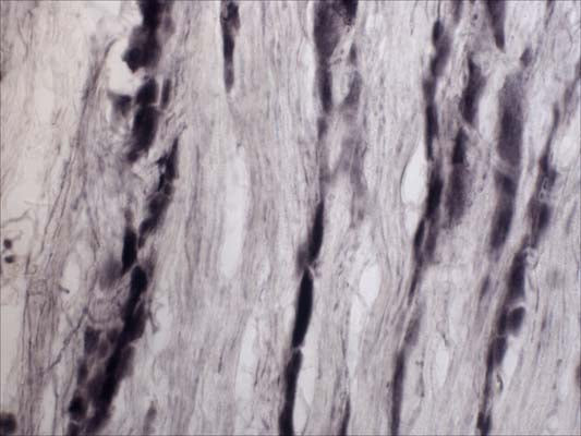 Anti-Tyrosine Kinase Receptor A (TrkA) Antibody - Image 2