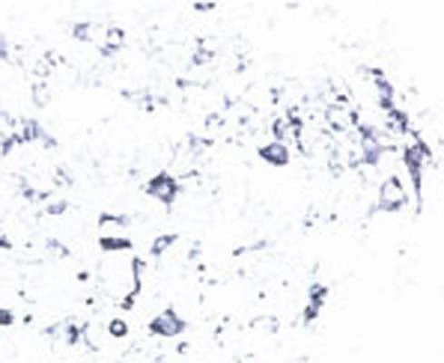 Anti-Tyrosine Kinase Receptor B (TrkB) Antibody