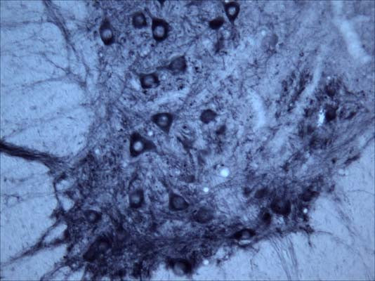 Anti-Tyrosine Kinase Receptor B (TrkB) Antibody - Image 3