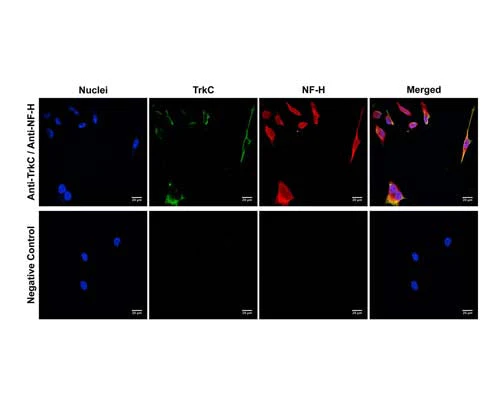 Anti-Tyrosine Kinase Receptor C (TrkC) Antibody - Image 3