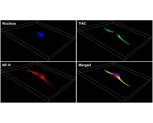 Anti-Tyrosine Kinase Receptor C (TrkC) Antibody - Image 4
