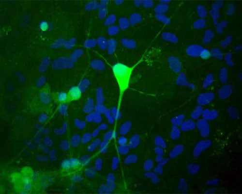 Anti-Ubiquitin C Terminal Hydrolase 1 (UCHL1) Antibody