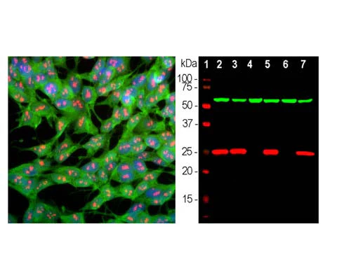 Anti-Ubiquitin C Terminal Hydrolase 1 (UCHL1) Antibody - Image 2
