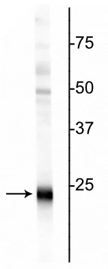 Anti-Ubiquitin C-terminal Hydrolase 1 (UCHL1) Antibody
