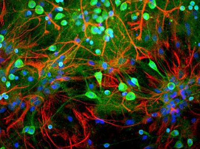 Anti-Ubiquitin C-terminal Hydrolase 1 (UCHL1) Antibody - Image 3