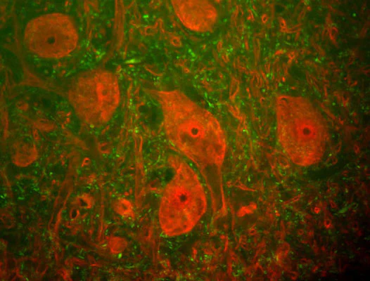 Anti-Ubiquitin C-terminal Hydrolase 1 (UCHL1) Antibody - Image 2