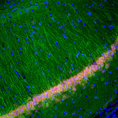 Anti-Ubiquitin C-terminal Hydrolase 1 (UCHL1) Antibody - Image 3