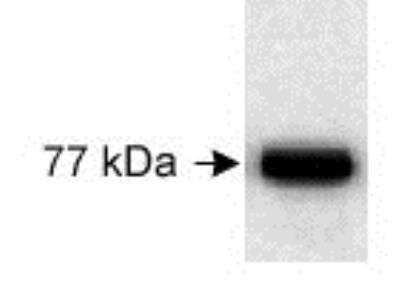 Anti-URP1 (Kindlin1) Antibody