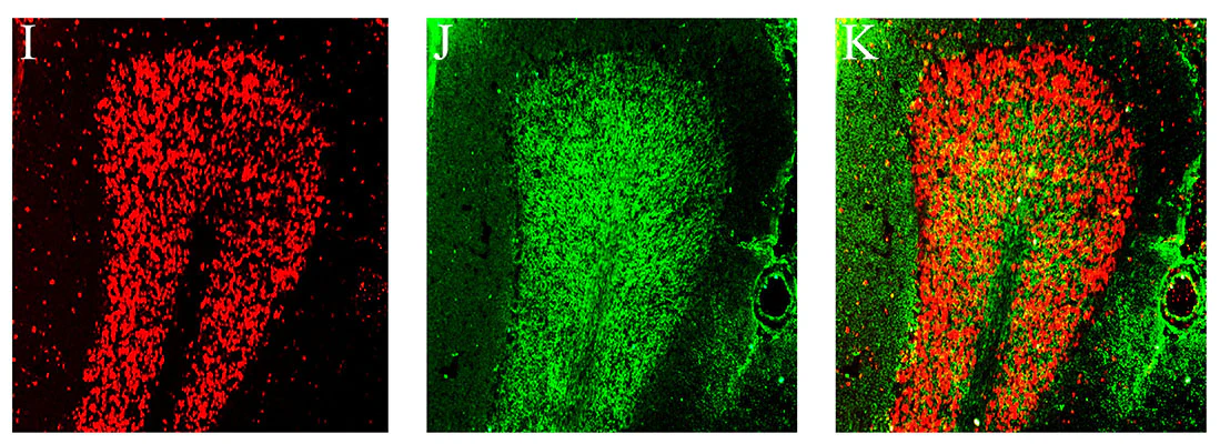 Anti-VaChT Antibody