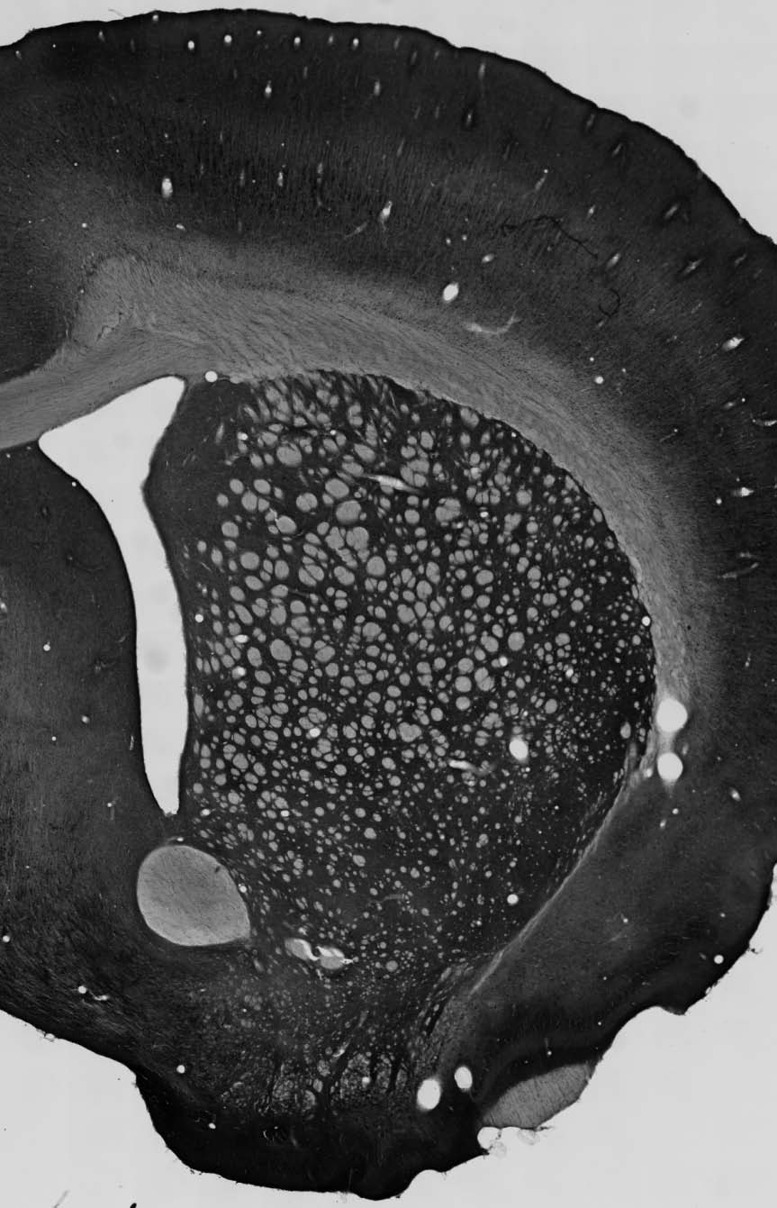 Anti-VaChT Antibody - Image 2