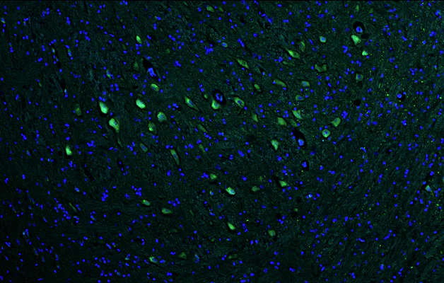 Anti-VAChT Recombinant Chicken Chimeric mAb