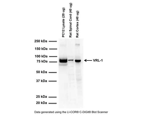 Anti-Vanilloid receptor-like protein 1 (VRL-1) Antibody - Image 3