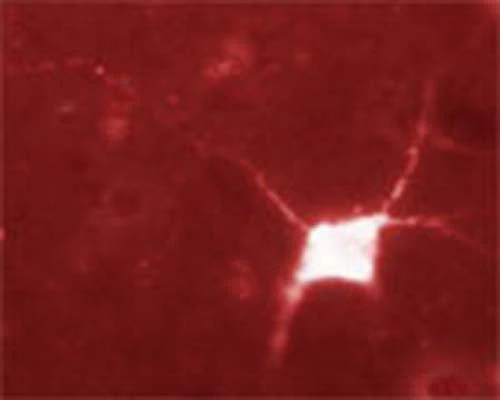 Anti-Vanilloid receptor-like protein 1 (VRL-1) Antibody