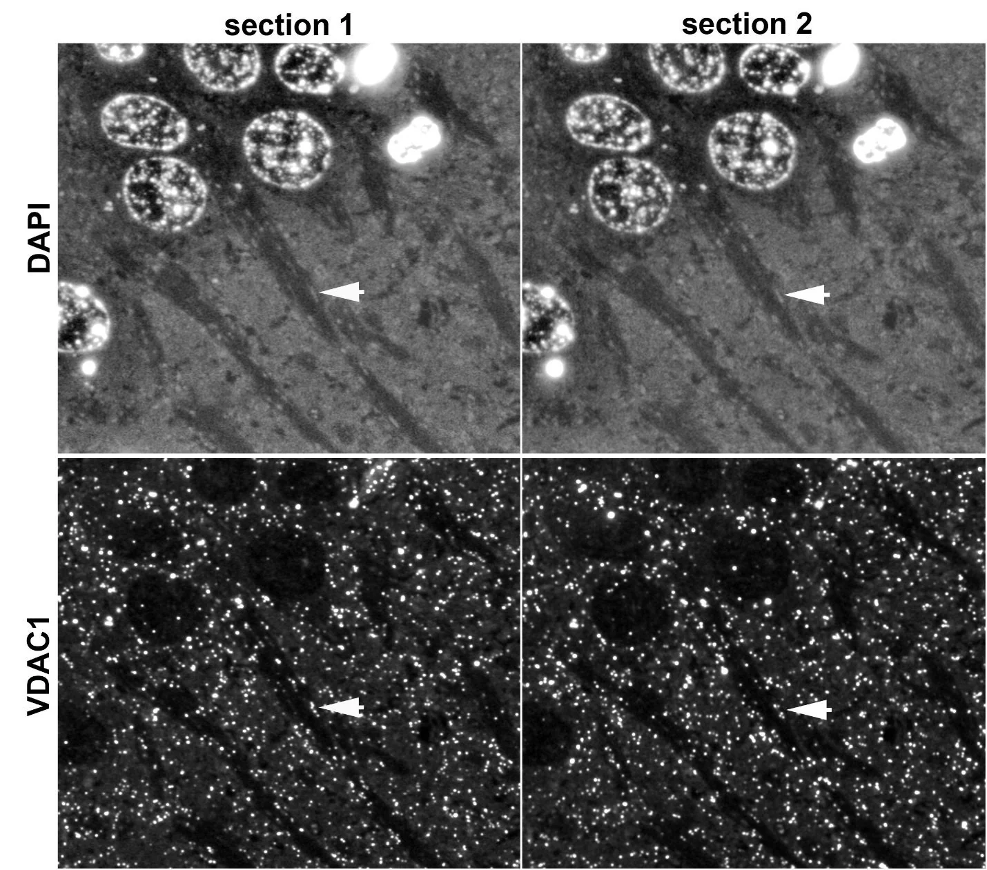Anti-VDAC1 Antibody - Image 2