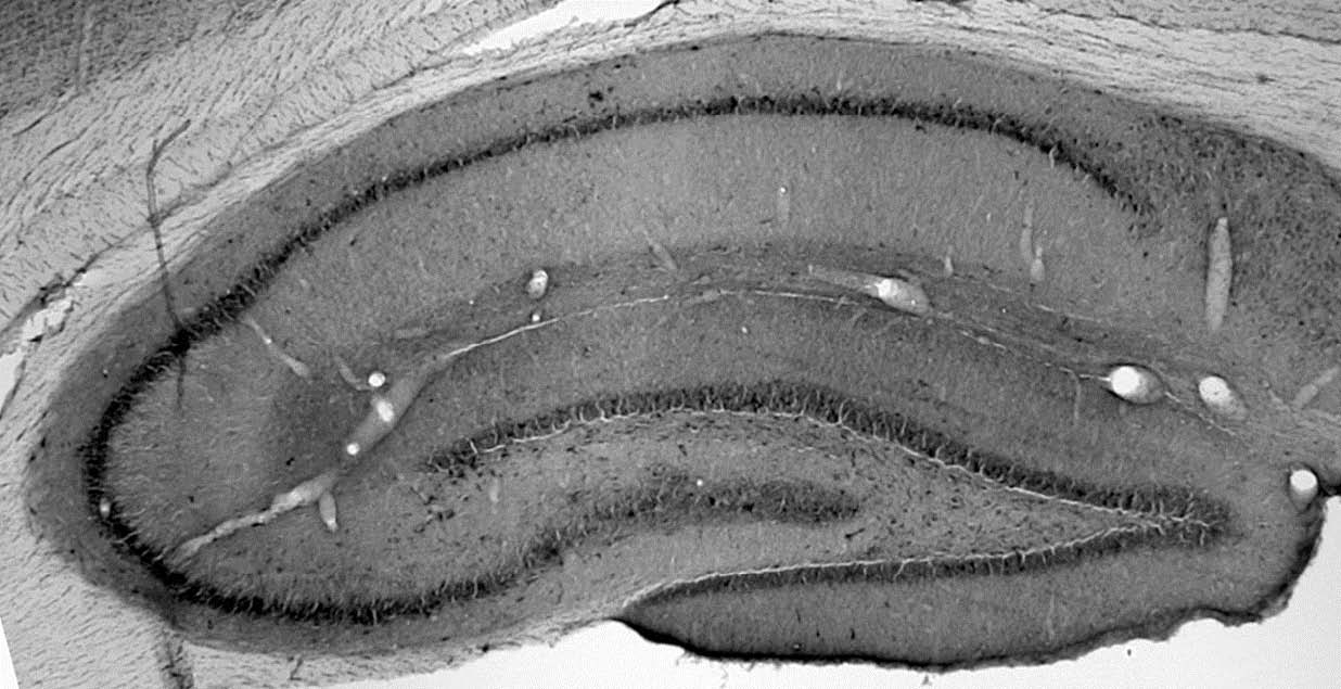 Anti-VDAC1 Antibody - Image 3